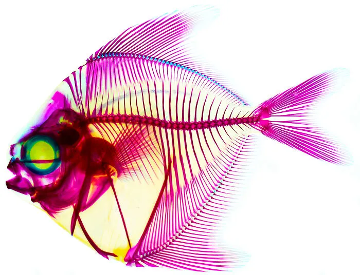 Microscopic image of a fish skeleton with vibrant purple and yellow hues from the 2025 Nikon Small World photomicrography contest.