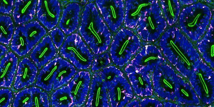 Microscopic image showing vibrant blue cells with glowing green structures, featured in Nikon Small World photomicrography contest.