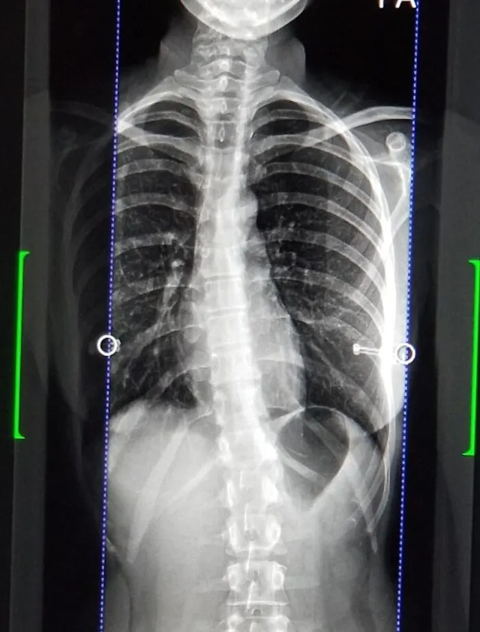 Struggling To Breathe For Years. Doctors Don't Help Because I'm "Too Young" To Be Having Issues