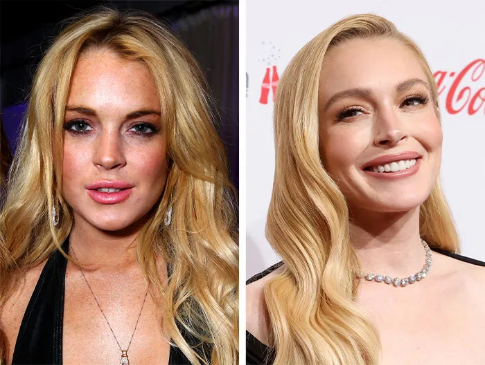 When done right, cosmetic procedures could really erase all those hard years