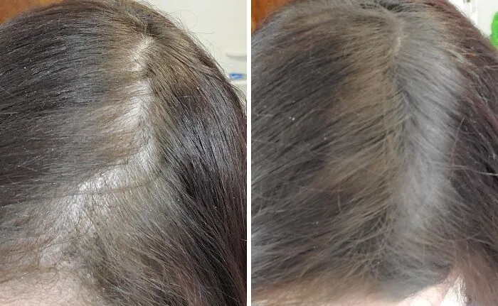 The Dreaded Post-Beanie Hair Reveal Won't Stand A Chance Against The Instant Fullness You'll Get From This <a Style="Display:inline;" Href="Https://Www.amazon.com/Hairline-Powder-Instantly-Shadow-Touch-Up/Dp/B07yjlpmc5?ie=utf8&th=1&linkcode=ll1&tag=bpfrog-20&linkid=4907d2e846329d82d35c23f71067bbc6&language=en_us&ref_=as_li_ss_tl" Target="_blank">  <span Style="Font: Inherit; Color: #d74b1f;"> Gowwim Hairline Powder </Span>