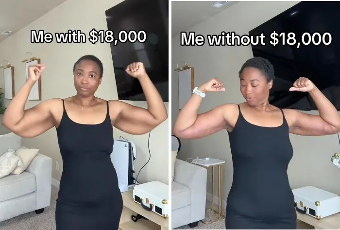 People Are Sharing What They Look Like After Plastic Surgery And Here Are 30 Examples