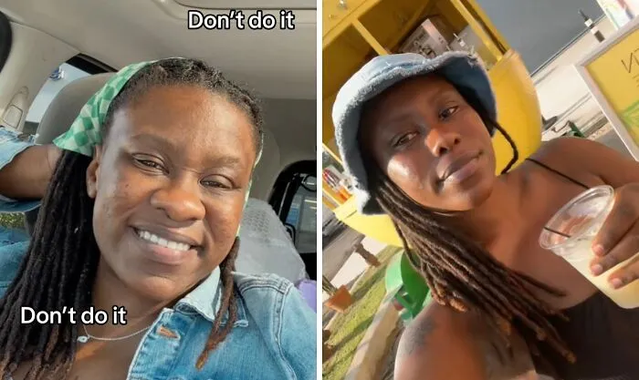 People Are Sharing What They Look Like After Plastic Surgery And Here Are 30 Examples