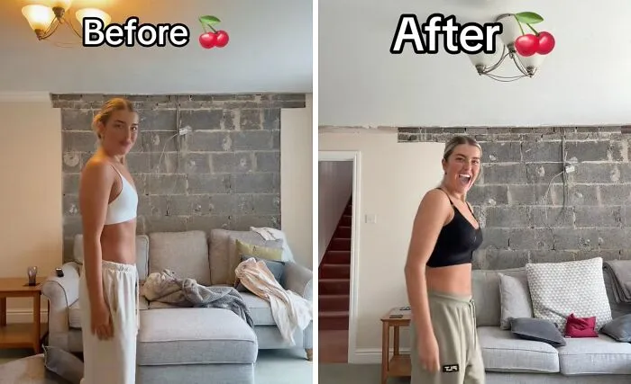 People Are Sharing What They Look Like After Plastic Surgery And Here Are 30 Examples