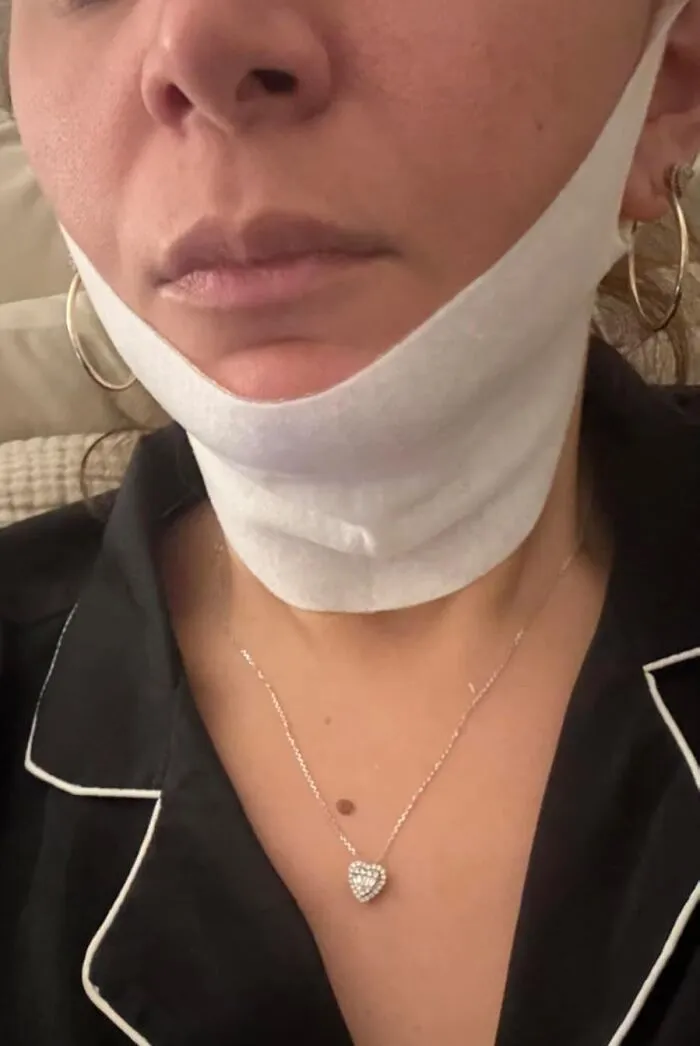 Your Chin Is About To Get A Pep Talk So Inspiring, It'll Forget All About The Concept Of Gravity With A <a Style="Display:inline;" Href="Https://Www.amazon.com/Maree-Gold-Collagen-Facial-Hyaluronic/Dp/B0cndckxdx?ie=utf8&linkcode=ll1&tag=bpferret-20&linkid=802b0032d2994732a5016a1ce0df35b3&language=en_us&ref_=as_li_ss_tl" Target="_blank">  <span Style="Font: Inherit; Color: #d74b1f;"> Maree V Line Lifting Mask </Span>