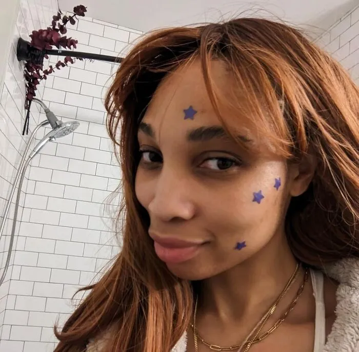 That Uninvited Guest On Their Face Can Now At Least Be A Cute Fashion Accessory With These <a Style="Display:inline;" Href="Https://Www.amazon.com/Livaclean-Superstar-Patches-Salicylic-Hydrocolloid/Dp/B0bl7vf565?ie=utf8&th=1&linkcode=ll1&tag=bpmole-20&linkid=5769006f5b1265dcefaa320c63287766&language=en_us&ref_=as_li_ss_tl" Target="_blank">   <span Style="Font: Inherit; Color: #d74b1f;"> Star Pimple Patches </Span>