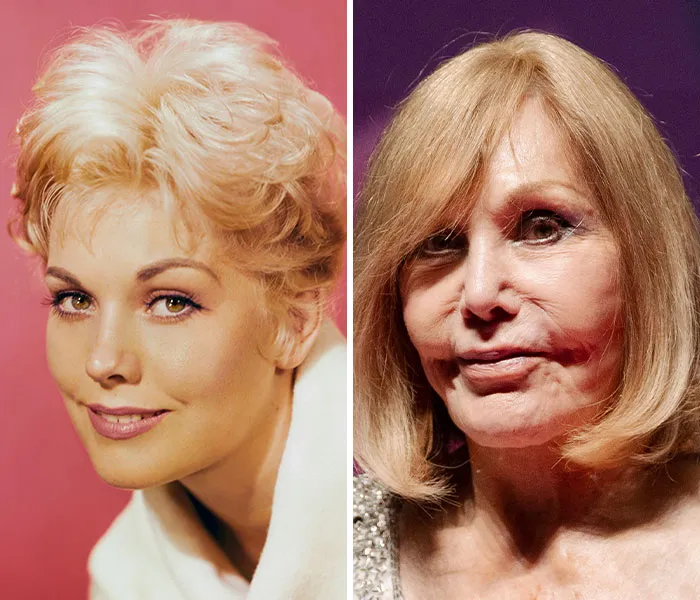 Kim Novak
