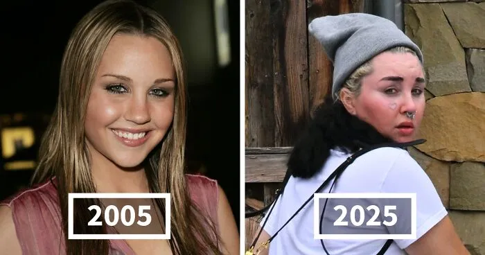 25 Then And Now Shots Of Stars In 2005, 2015 And 2025, Including One Who Was Left "Disfigured"