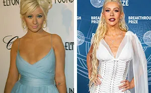 18 fotos de “Antes y después” de celebridades entre 2005, 2015 y 2025, incluyendo a una que quedó “desfigurada”