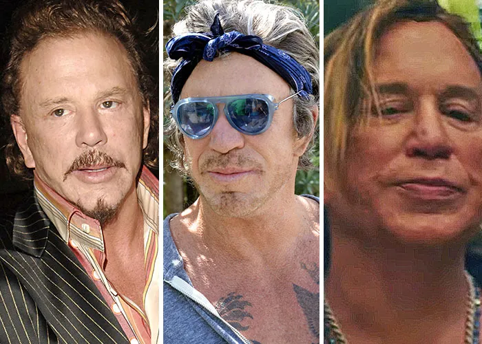 Then and now shots of stars showing changes from 2005, 2015, and 2025 including one left disfigured