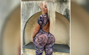 "She Learned Her Lesson": 15 Times BBL Surgeries Went Horribly Wrong