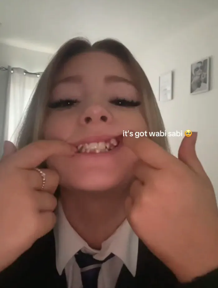 Young woman showing her imperfect teeth with a smile, embracing perfect imperfections in a wholesome trend video.