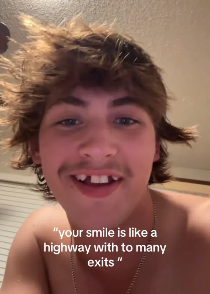 Young man with missing front teeth smiling, sharing perfect imperfections in a wholesome trending photo.