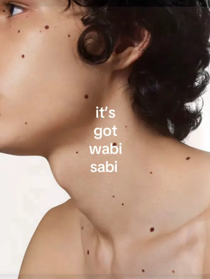 Close-up of a person’s neck and shoulder showing multiple moles, highlighting perfect imperfections and natural beauty.