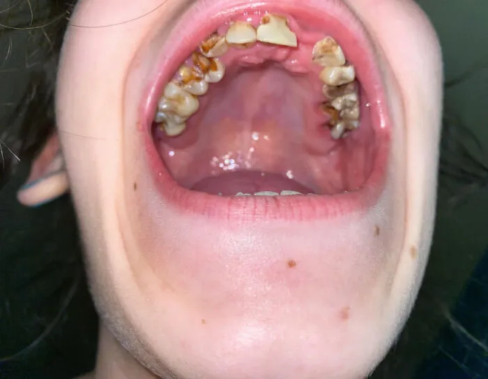 “She Had Mold”: 37 Times Dentists Had To Try Hard Not To Show Their Surprise And Disgust