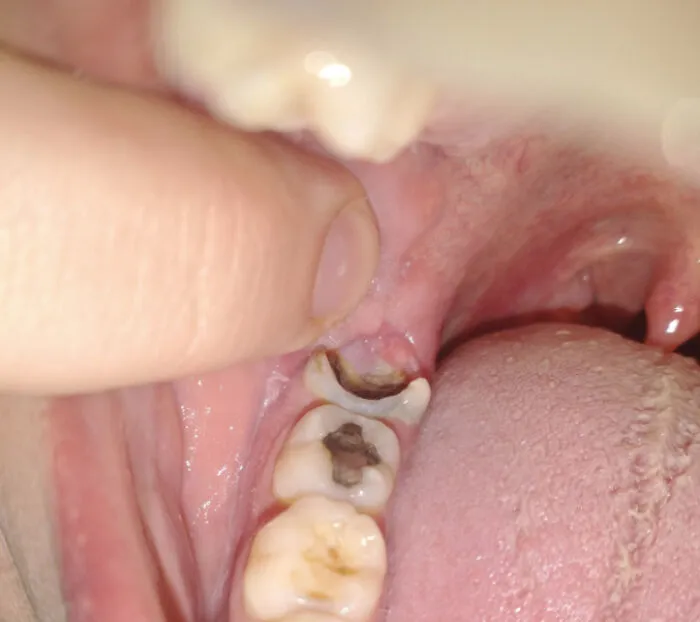 “She Had Mold”: 37 Times Dentists Had To Try Hard Not To Show Their Surprise And Disgust