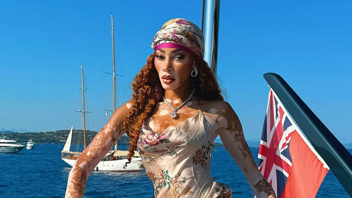 Winnie Harlow Breaks Silence After Massive Backlash Over 'Disrespectful' Whitney Houston Halloween Look