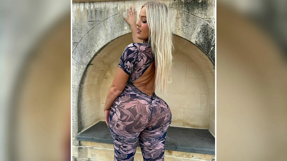 "She Learned Her Lesson": 15 Times BBL Surgeries Went Horribly Wrong