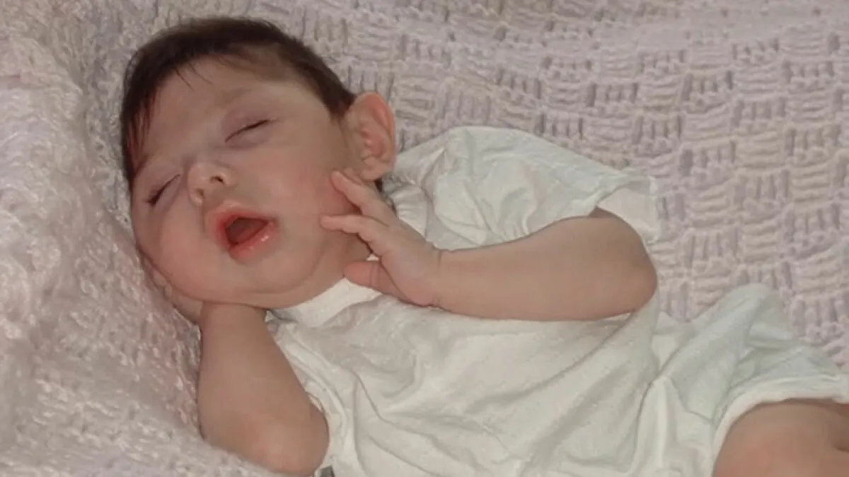 Woman Born Without Most Of Her Brain Turns 20, Family Speaks Out And It Sparks A Heated Debate