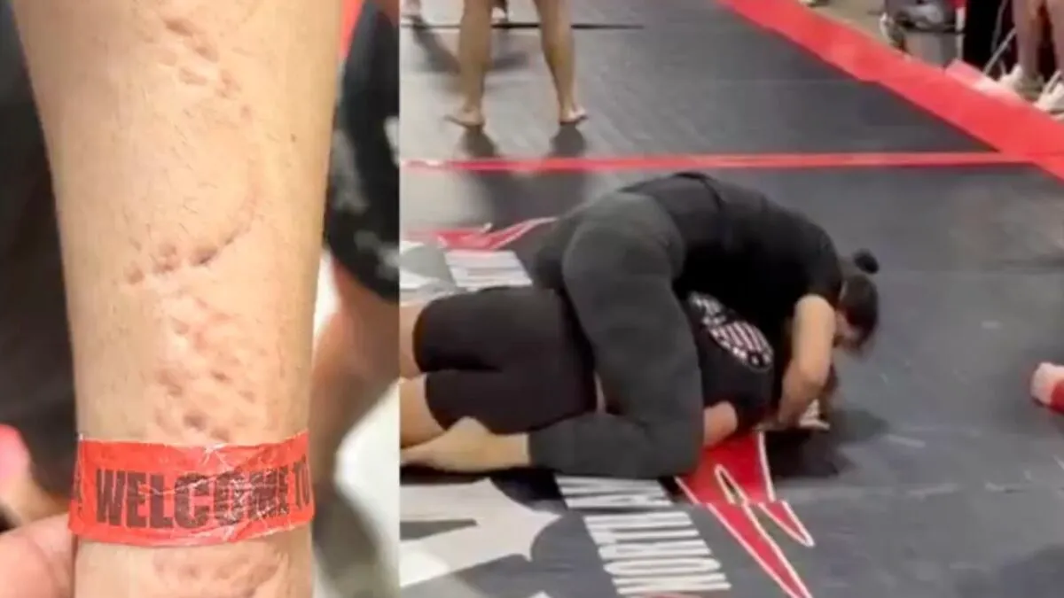 “Completely Insane”: Jiu-Jitsu Athlete Brutally Bitten By Opponent During Match In Viral Video