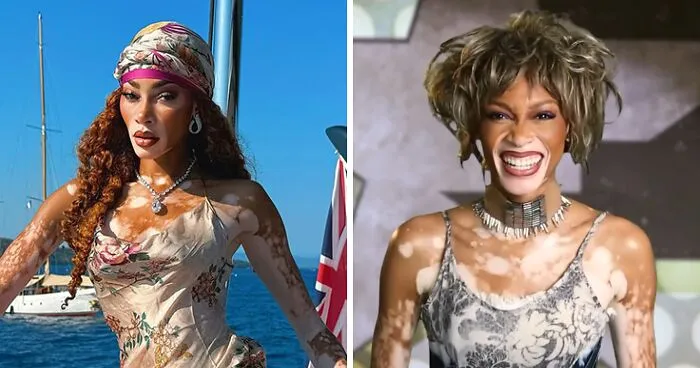 Winnie Harlow Breaks Silence After Massive Backlash Over 'Disrespectful' Whitney Houston Halloween Look
