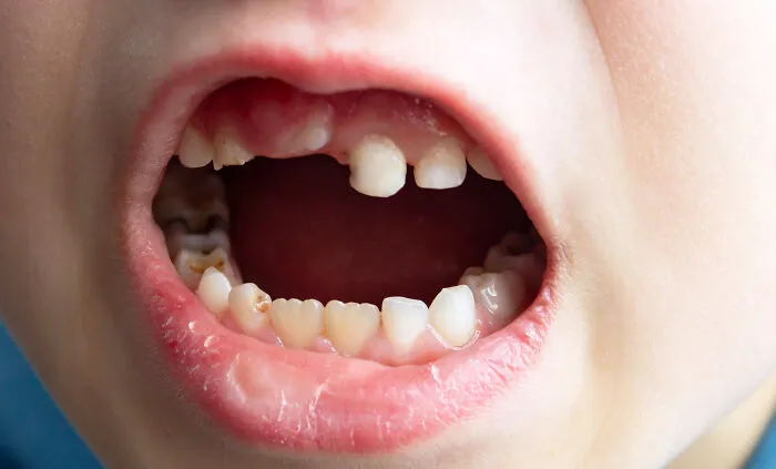 “She Had Mold”: 37 Times Dentists Had To Try Hard Not To Show Their Surprise And Disgust