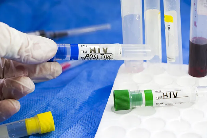 “I Was Horrified”: 34 Surgeons And Doctors Recall Their Worst Mistakes