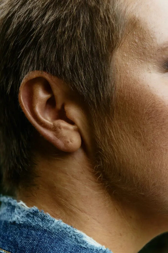 46 Times People Thought They Had A Mysterious Medical Issue But Finally Figured It Out