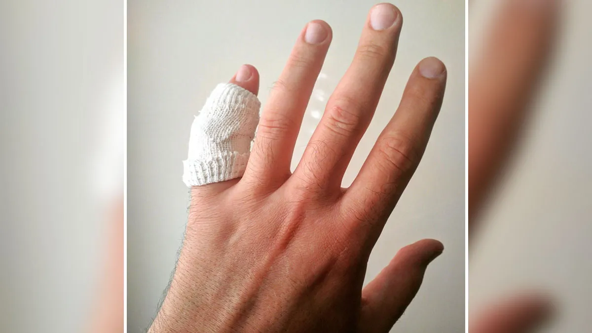 48 Times People Got Hurt In The Dumbest Ways And Had No Choice But To Visit The ER