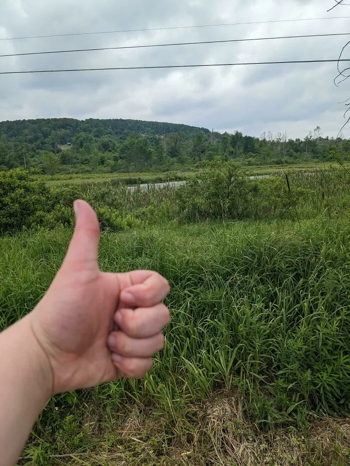 I'm 16, Over 300lbs, And Just Went On My First Walk In Over A Year