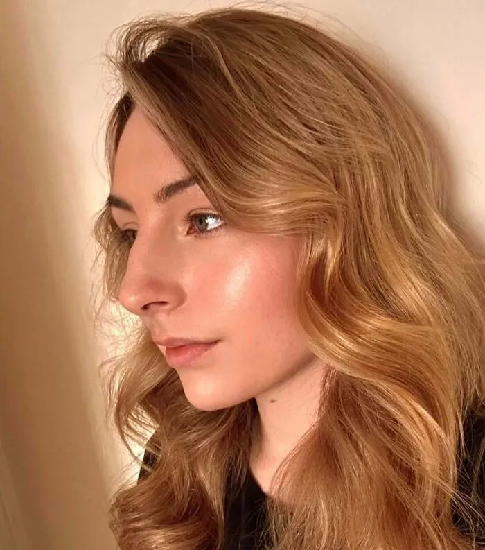 18 Months Today Since I Made The Decision To Cancel My Nose Job And Never Look Back