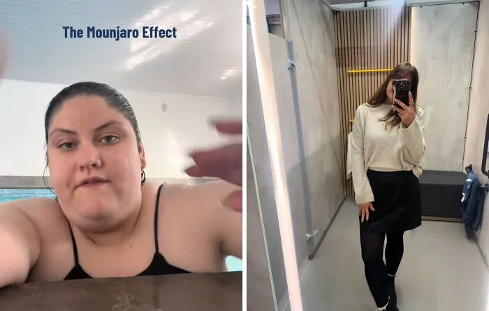 40 Real Mounjaro Users Reveal Their Before-And-After Weight Loss Results