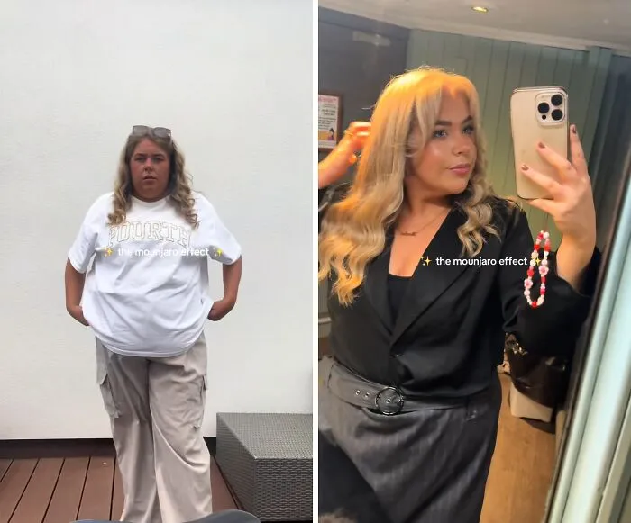 40 Real Mounjaro Users Reveal Their Before-And-After Weight Loss Results