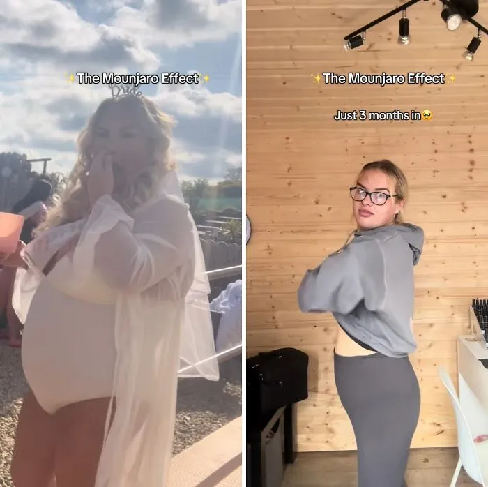 40 Real Mounjaro Users Reveal Their Before-And-After Weight Loss Results