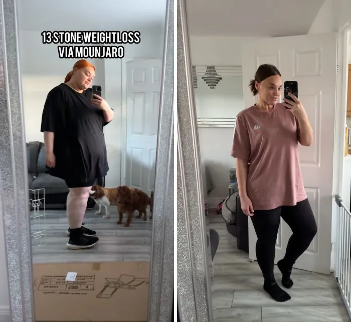40 Real Mounjaro Users Reveal Their Before-And-After Weight Loss Results