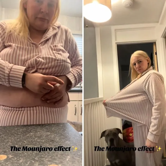40 Real Mounjaro Users Reveal Their Before-And-After Weight Loss Results