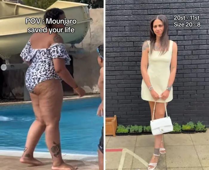 40 Real Mounjaro Users Reveal Their Before-And-After Weight Loss Results