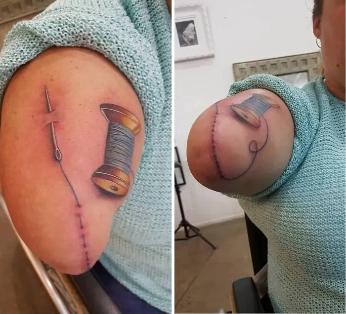A Good Friend Had Her Arm Stump Tattooed