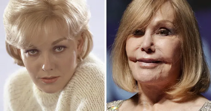 Kim Novak