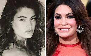 10 “Mar-a-Lago” Face Transformations That Left People Utterly Stunned