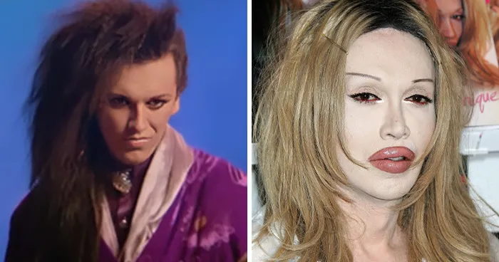 Pete Burns