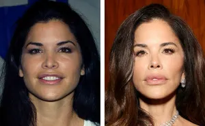 10 transformaciones faciales a lo “Mar-a-Lago” que dejaron a la gente completamente atónita