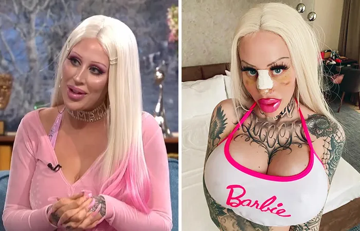 Alicia Amira - Spent $120k On Surgeries