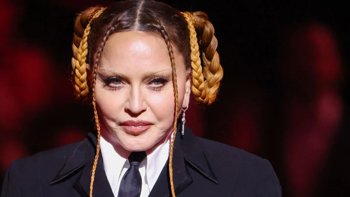 20 Famous People Who Might Have Gone Too Far With Plastic Surgery