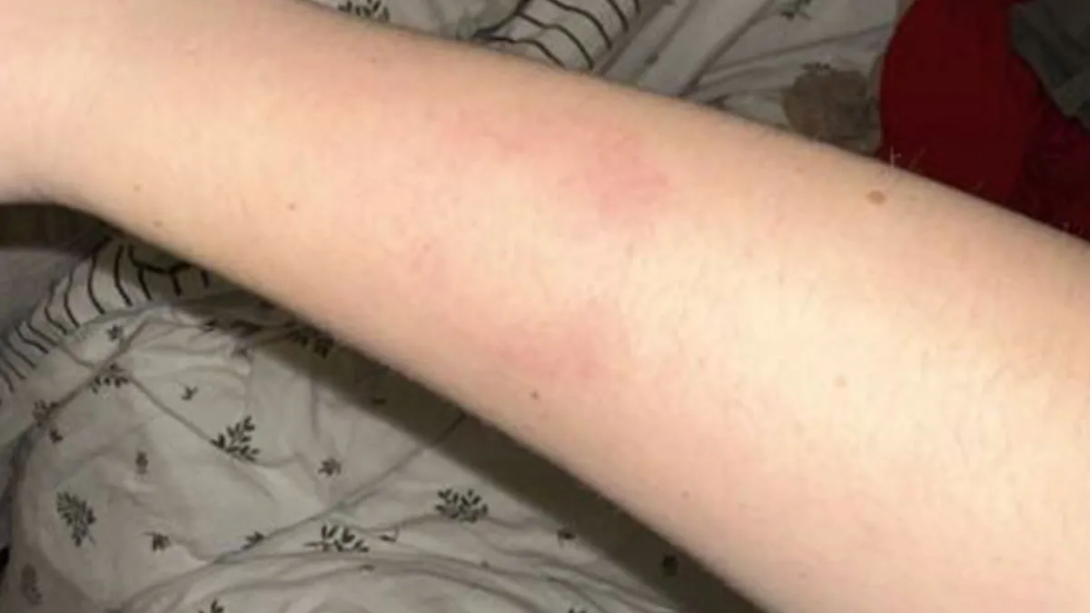 Lady Refuses To Babysit 14YO Autistic Nephew Again Or Attend Fam Christmas After He Bites Her 