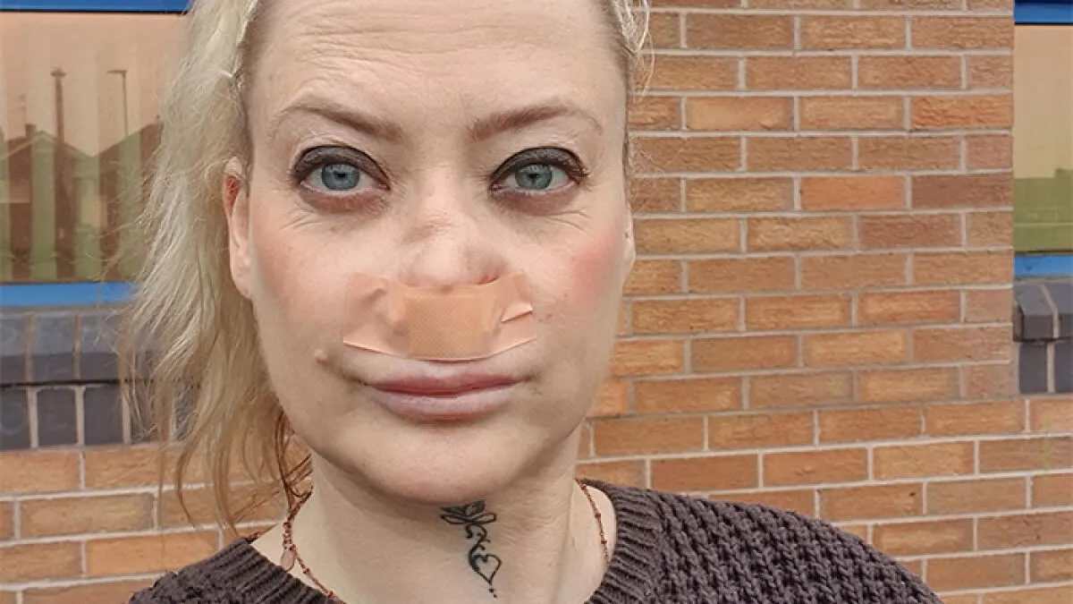 “My Face Is Changing Every Day!”: Woman's $4k 'Turkey Teeth' Procedure Goes Horribly Wrong