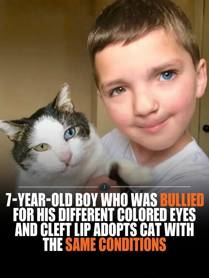 Sadly, He Was Often Bullied By Other Kids Just For Looking Different. But The Universe Had A Plan
