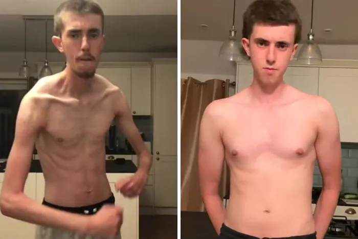38 Before-And-After Transformations That Might Leave You Speechless