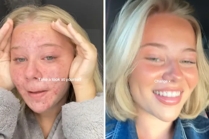 38 Before-And-After Transformations That Might Leave You Speechless