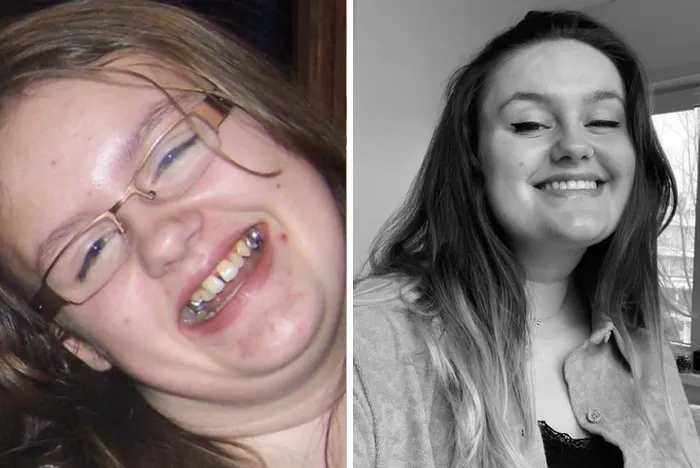 38 Before-And-After Transformations That Might Leave You Speechless